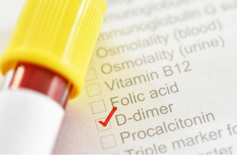 Xét nghiệm D-dimer là gì? Đọc kết quả và lưu ý khi xét nghiệm D-dimer | Medlatec
