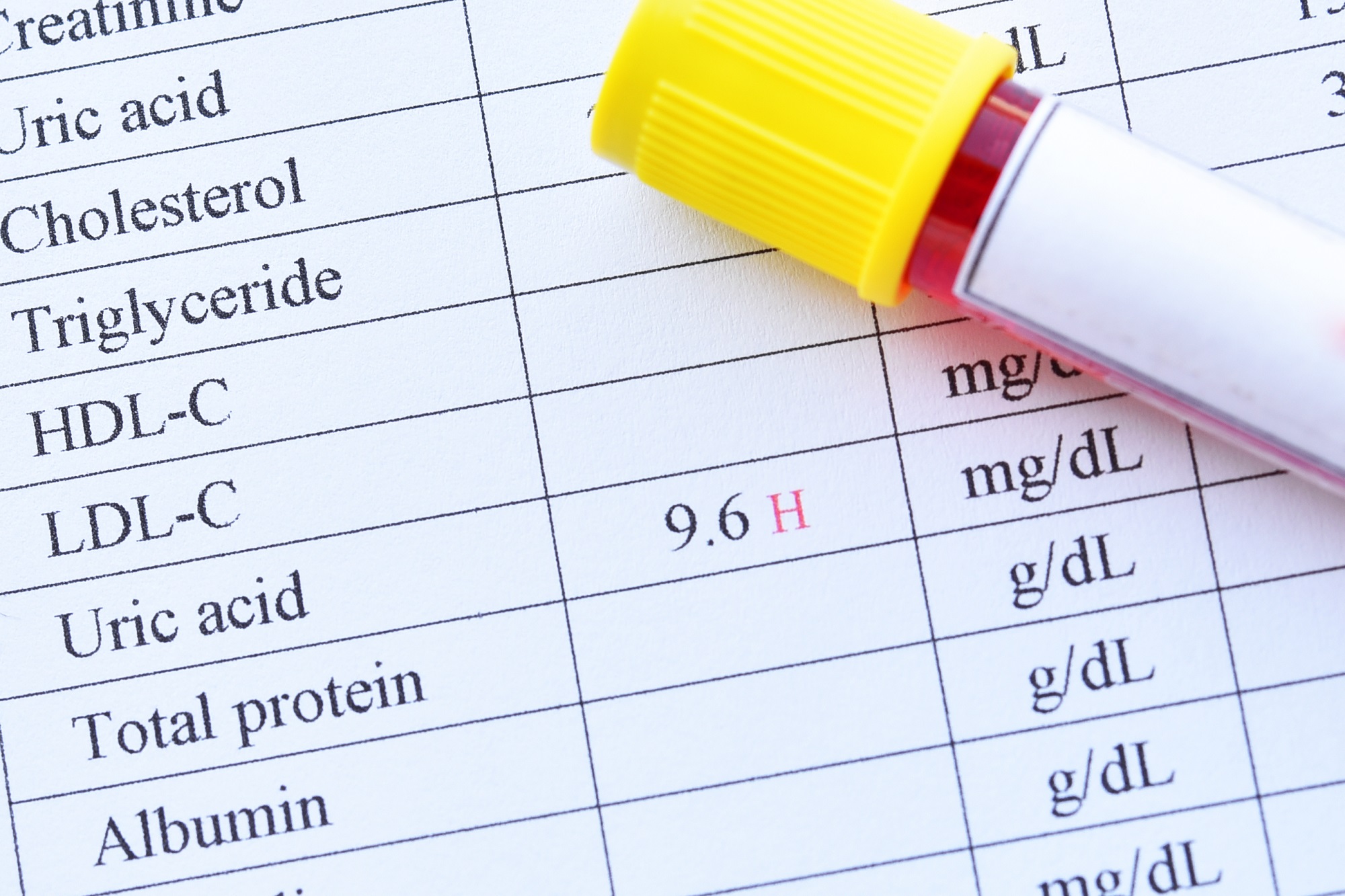 Các tiêu chí đánh giá bệnh Gout | BvNTP