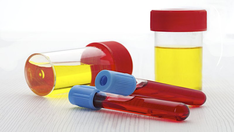 Xét nghiệm Cortisol nước tiểu | BvNTP