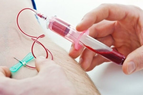 Thực hiện xét nghiệm máu lắng để làm gì?