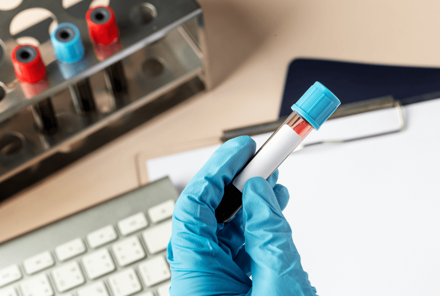 Xét nghiệm kháng thể - Xác định miễn dịch sau tiêm vaccine